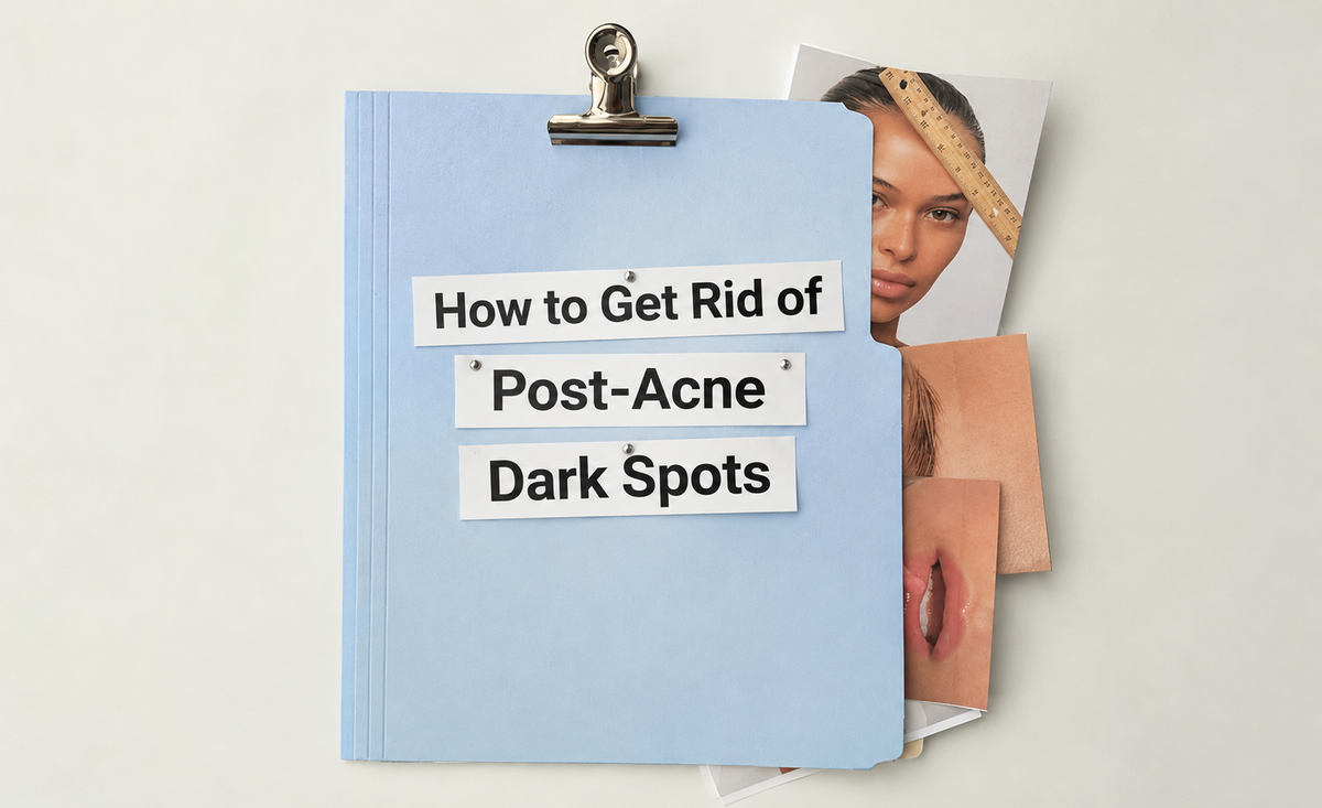 How to Get Rid of Post-Acne Dark Spots skincare guide cover featuring a baby blue folder, bold black typography, and beauty editorial photos of facial skin and lips on a minimalist cream background.