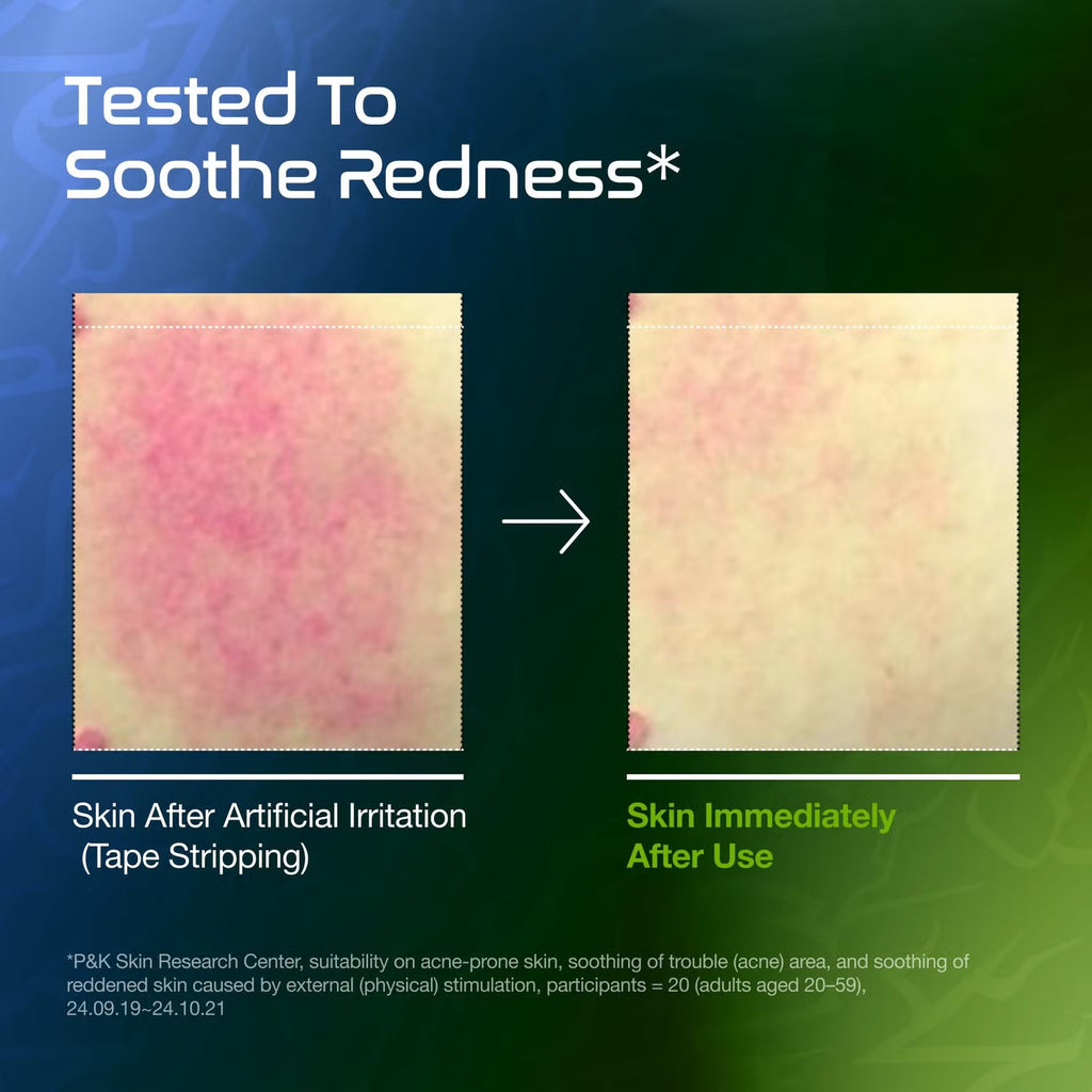 A comparison graphic showing skin after artificial irritation with redness on the left and skin immediately after use on the right, with the headline 'Tested To Soothe Redness*' and explanatory text below on a blue-to-green gradient background. test result for Anua x KPop Demon Hunters, Azelaic Acid 10 Hyaluron Redness Soothing Serum